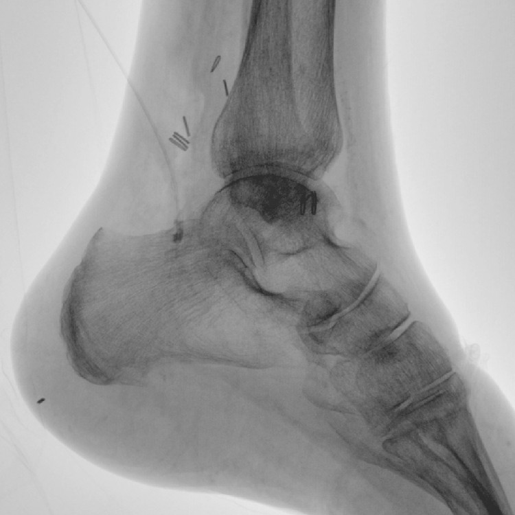 C arm x ray machine.jpg