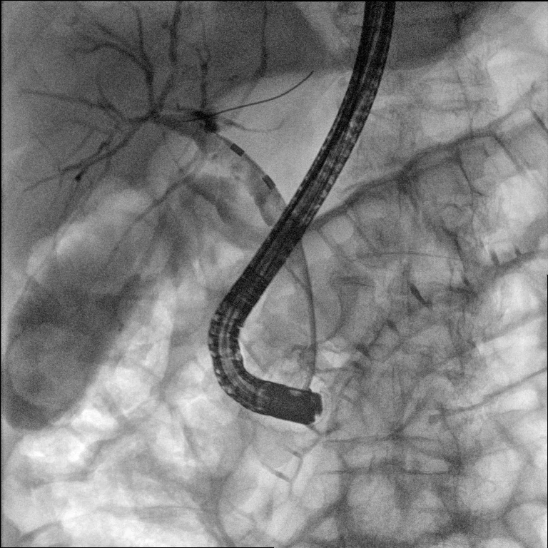 mobile c arm x ray.bmp