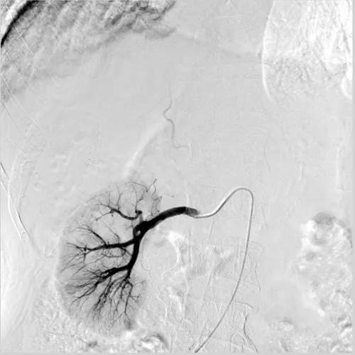 angiography system angiography system