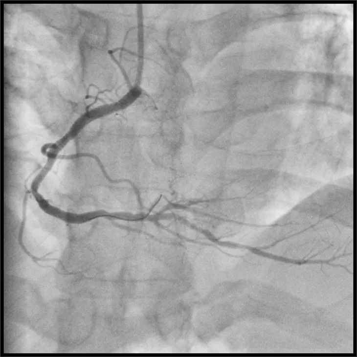 Cardiac Cath Lab