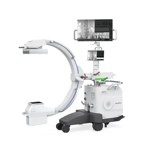 HD Vision Compact Mobile C-arm X-ray System-Phoenix 200